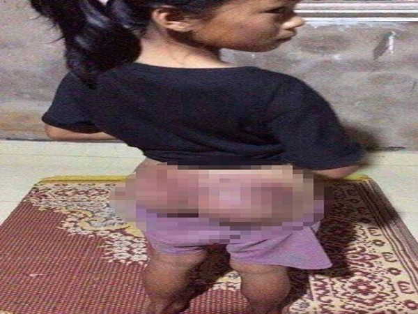    Cháu G. bị đánh đập dã man do nghi ngờ trộm tiền.