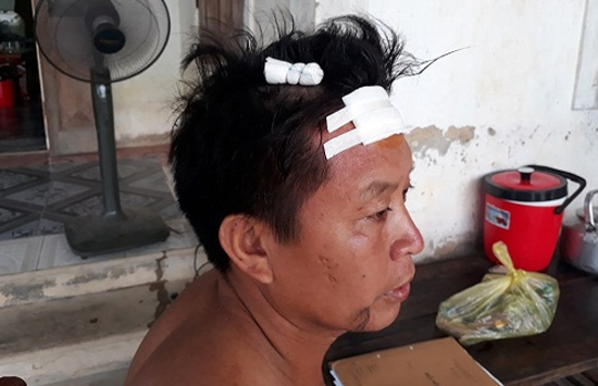 Chủ nhà bị đánh trọng thương